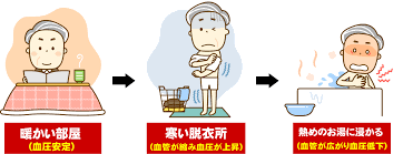 「ヒートショック」